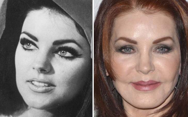 Priscilla Presley Plastic Surgery - The Real Truth